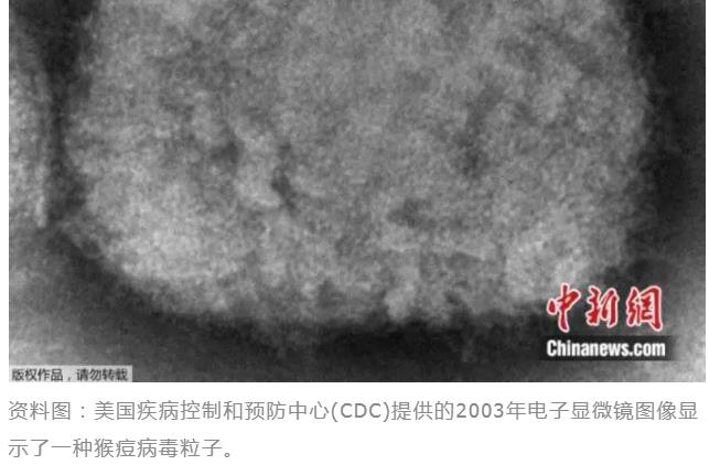 猴痘病毒已发生人际传播，如何保护自己→